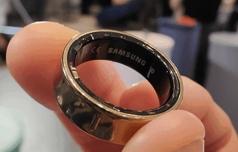 Galaxy Ring Alarm Veriyor: Parmakta Şişen Pil Panik Yarattı!
