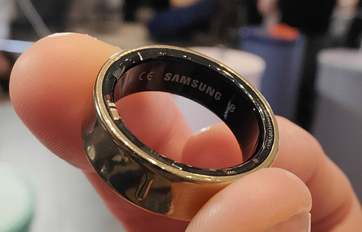 Galaxy Ring Alarm Veriyor: Parmakta Şişen Pil Panik Yarattı!