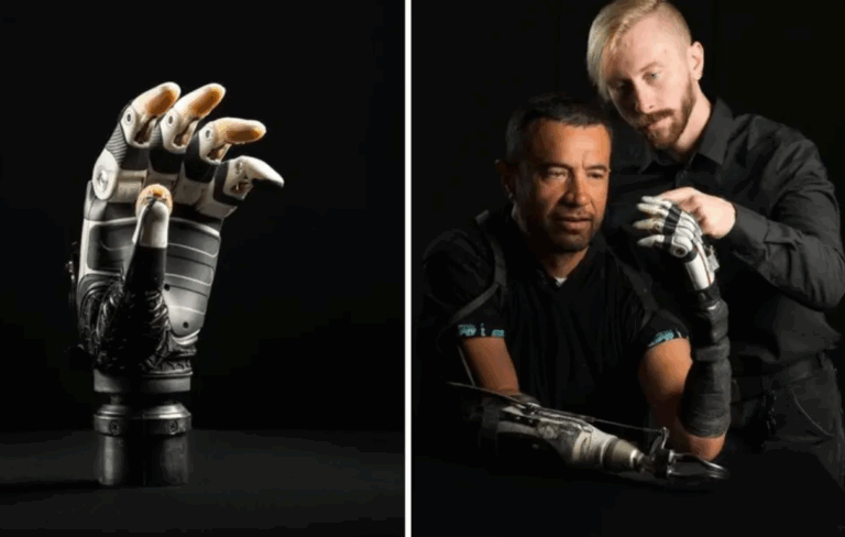 Utah Üniversitesi’nden Devrim Niteliğinde Biyonik El: Yapay Zekâ ile Kendi Kararını Veriyor