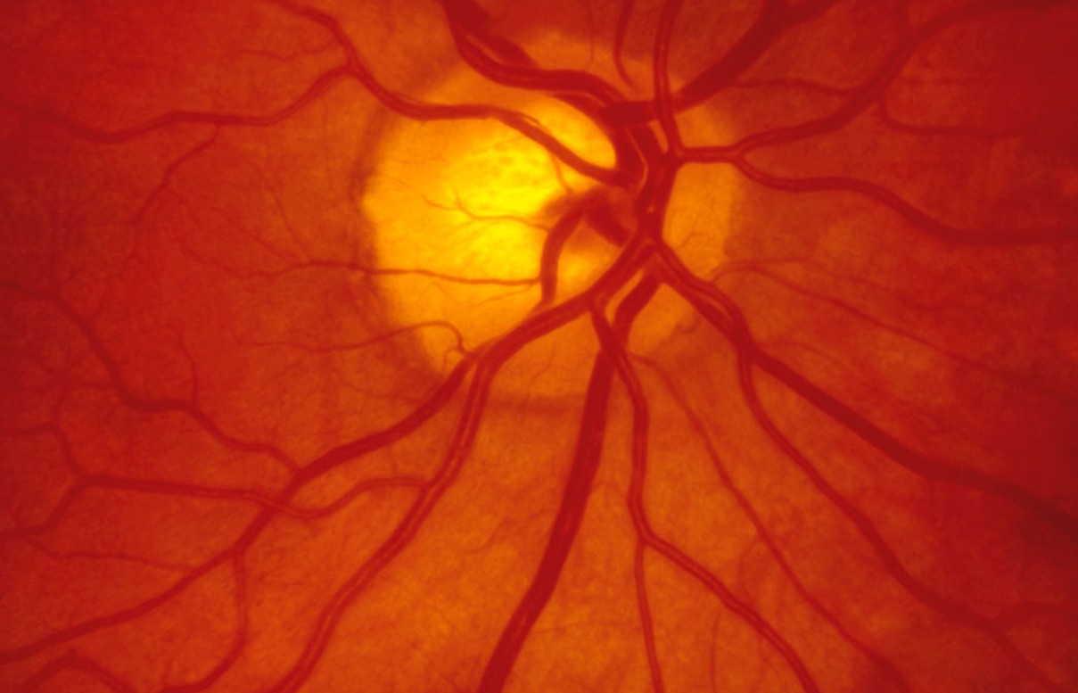 Görme Kaybına Karşı Umut: Bilimden Büyük Keşif