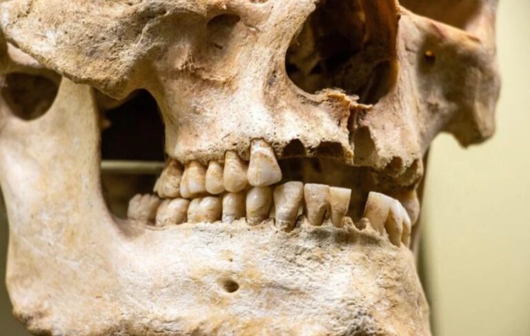 59.000 Yıllık Neandertal Dişinde “Ameliyat” İzleri